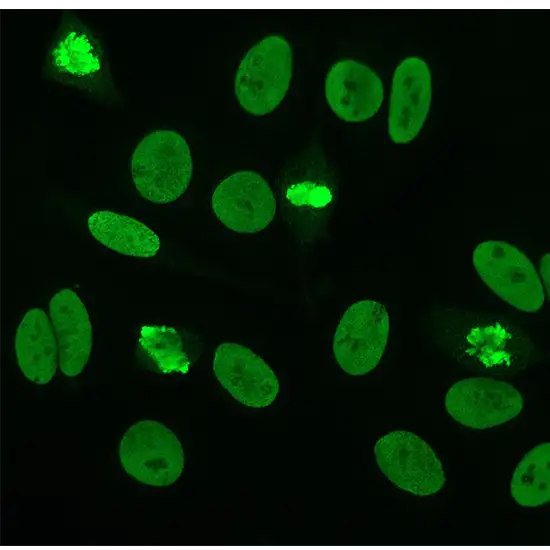 anti sm (smith) anti body igg (elisa)